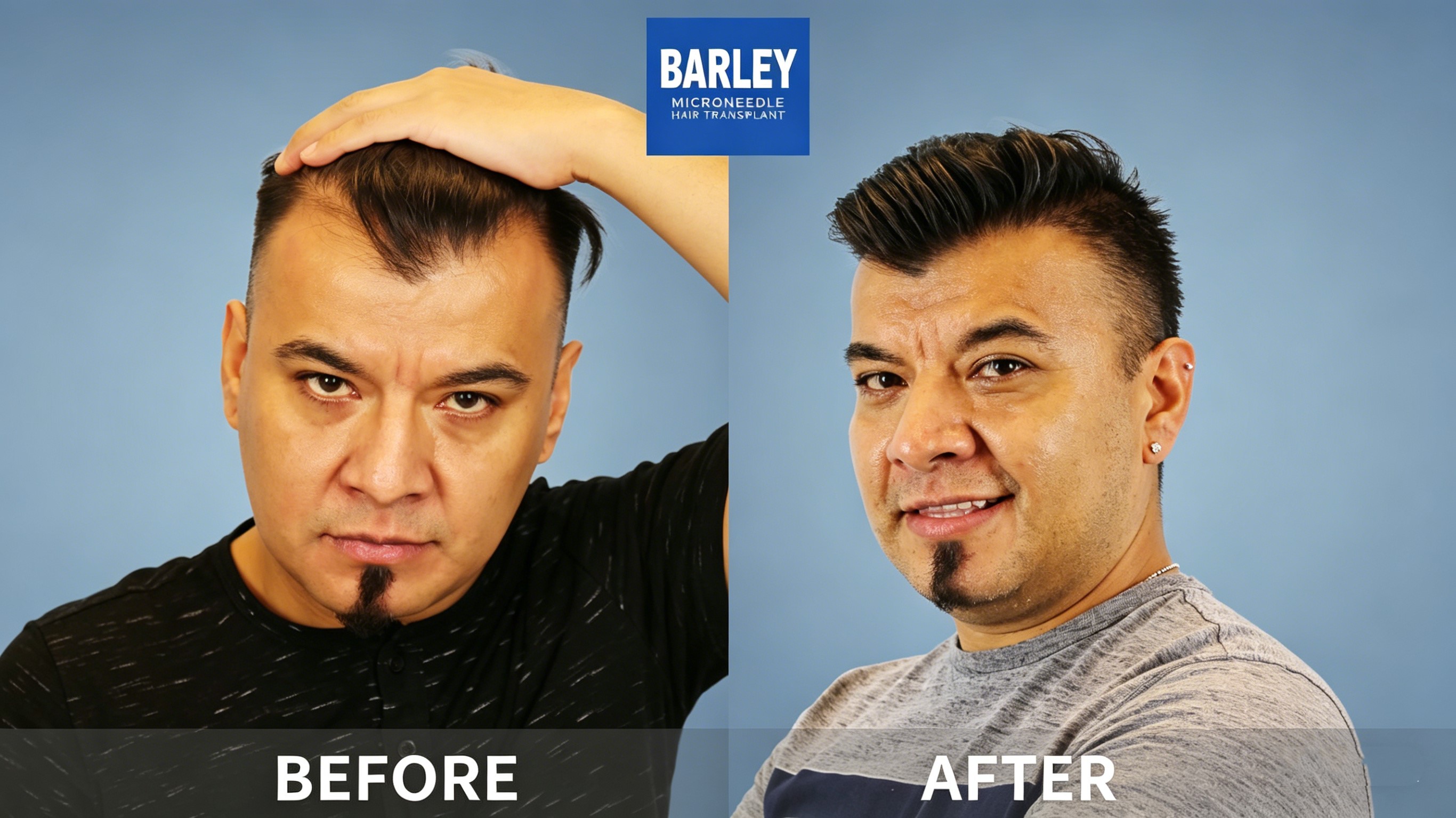 Daily Hair Loss and Balding - Understanding the Connection