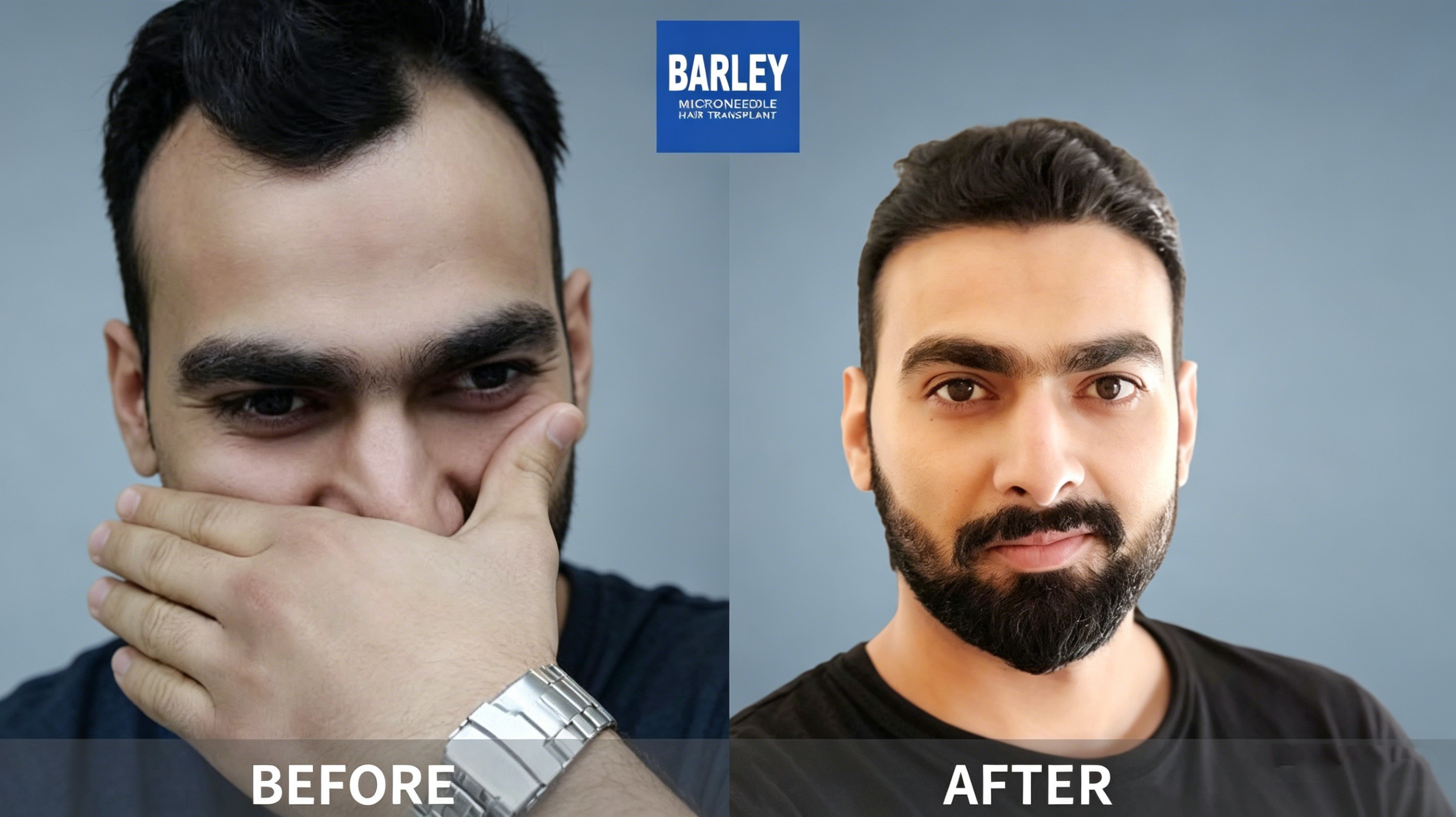 Hair Loss Treatment and Prevention Guide