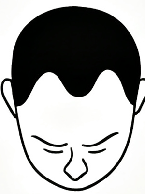 Stage 2 - Slight recession